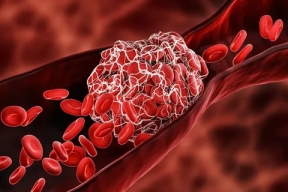 Волгоградские ученые разработали более эффективное и безопасное средство от тромбоза, чем аспирин